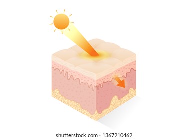 UV ray from Sunlight penetrate into deep human skin layer. Illustration about haelth care and medical.