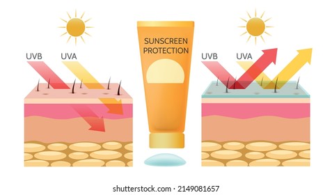 Uv Rays Skin Protection. Uva Uvb Sunscreen Protecting Vector Illustration, Sun Radiation Damage Barrier Epidermis Diagram, Summer Sunblock Human Ultraviolet Protect Infographic