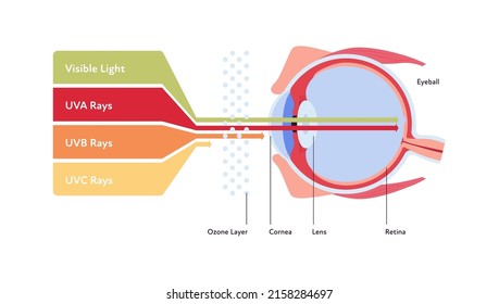 Rayos Uv e infografía visible de asistencia sanitaria ligera. Ilustración plana vectorial. Las luces UVA, UVB, UVC pasan de capa de ozono a bola ocular. Diseño para el mes de concientización y oftalmología del vih.