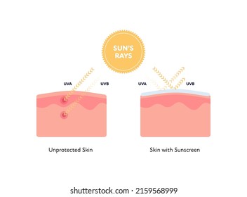 Uv rays and visible light healthcare infographic. Vector flat people illustration. UVA, UVB arrow penetarate unprotected and reflect from protected skin layers. Design for uv awareness month.