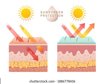Uv skin protection. Damaged human skin peels before and after sun protection body adipose layers epidermis recent vector infographic template - Shutterstock ID 1886778436