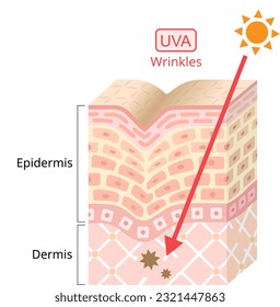 UVA radiation penetrate into the skin. 