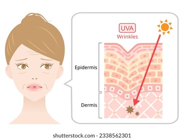 UVA radiation penetrate into skin on woman’s face that is resulting in winkles. Beauty and heath care concept