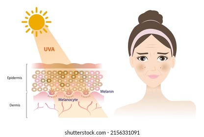 UVA rays penetrate into the dermis skin layer, damage woman face, resulting in a tan, melasma, aging, wrinkle, dark spots vector isolated on white background.Skin care concept illustration.