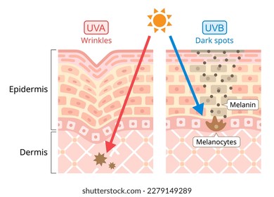 UVA and UVB damages to human skin. Ultraviolet A has a longer wavelength. It is associated with winkles. Ultraviolet B has a shorter wavelength. It is associated with dark spot. beauty and health care