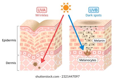 UVA and UVB radiation penetrate into the skin