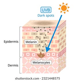 UVB radiation penetrate into the skin. 