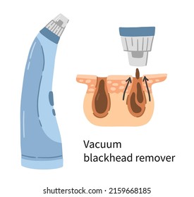 Vacuum blackhead remover vector illustration with layers of dermis and pores. Electric facial device for skin care and washing in a doodle cartoon style. Removal of comedo and dead cells