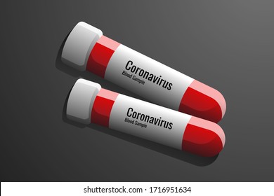 vacuum tubes of blood samples on a dark background. The concept of Covid-19 or Coronavirus
