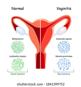Normal Vaginas