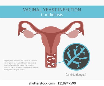 Vaginal Intercourse Images, Stock Photos & Vectors | Shutterstock