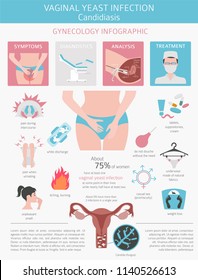 Vaginal yeast infection. Candidiasis. Ginecological medical desease infographic. Vector illustration