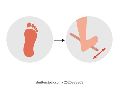 Problema do pé Valgus. Exercícios especiais para o problema da deformação dos alimentos. Ortopedista Pé terapêutico e fortalecedor com vara