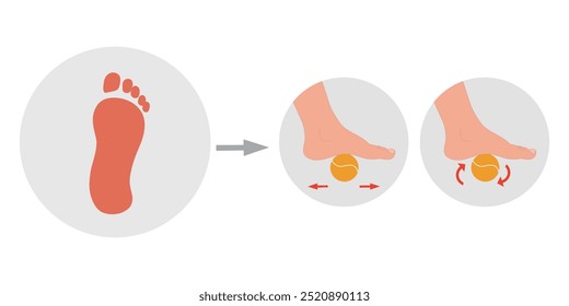 Problema do pé Valgus. Exercícios especiais para o problema da deformação dos alimentos. Ortopedista Pé terapêutico e fortalecedor com bola de tênis