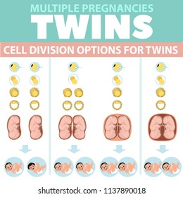 Variants of cell division under twins. Infographics. Detailed vector Infographic. Baby Health