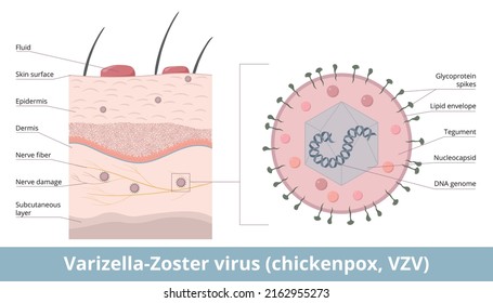 Varicella-Zoster virus (chickenpox, VZV). Detailed scheme of Varizella-Zoster virion, including DNA genome, nucleocapsid, and glycoprotein spikes. Viral infection in skin layer through nerve fiber.