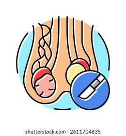 varicocelectomy surgery color icon vector. varicocelectomy surgery sign. isolated symbol illustration