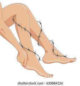 Varicose Or Leg Pain Concept. Barbed Wire Symbolizes Stiffness, Pain And Discomfort. Slender Female Legs And Feet, Hand Holding One Of The Heels. Vector Illustration Isolated On White.