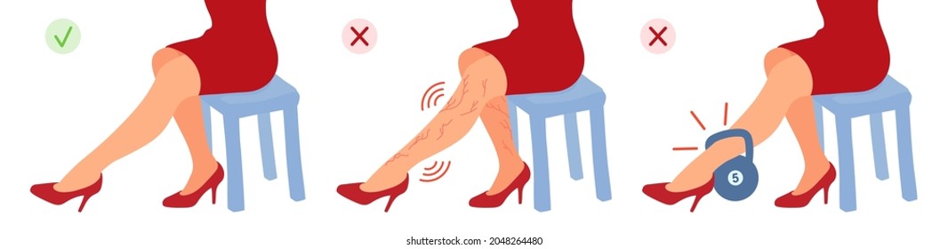 Varicose spider veins on woman legs. Heaviness, varicosity, pain. A girl wears high heels, tired. Healthy and unhealthy legs comparison. A vector cartoon illustration.