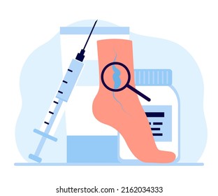 Varicose And Vein Thrombosis, Treatment Leg. Drugs And Medical Instruments Medication Foot With Diseased Veins. Examination Blood Vessels And Veins, Health Care. Vector Illustration