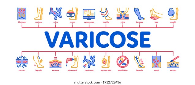 Varicose Veins Disease Minimal Infographic Web Banner Vector. Varicose Symptoms And Treatment, Legs Pain And Medicine Cream, Ultrasound And Surgery Color Illustration