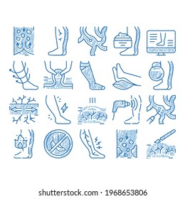 Varicose Veins Disease sketch icon vector. Hand drawn blue doodle line art Varicose Symptoms And Treatment, Legs Pain And Medicine Cream, Ultrasound And Surgery Illustrations