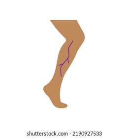 Varicose Veins Icon. Vascular Mesh On The Legs. Venous Disease. Vector Icon