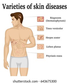 Varieties of skin diseases on the body of a young man