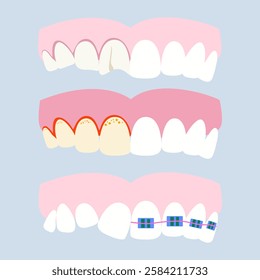 Various dental problems and diseases. Oral problems, caries, tartar, plaque, orthodontic braces, various injuries. Vector illustration