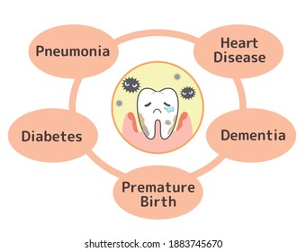 Various Diseases Caused By Periodontal Disease: Pneumonia, Diabetes, Etc.