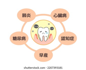 Various diseases caused by periodontal disease: pneumonia, diabetes, etc.[Translation:Periodontal disease and heart disease, dementia, Alzheimer's disease]