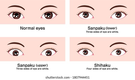 Diversas formas oculares (diferente tamaño y posición del globo ocular) ilustración vectorial ( clasificaciones asiáticas )
