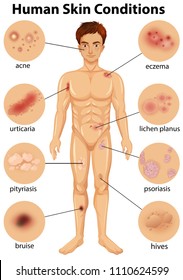 Various human skin conditions illustration