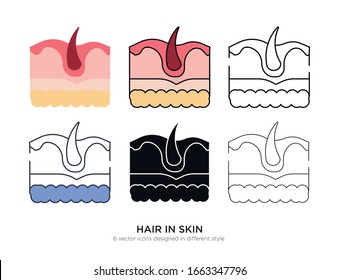 Diversos tipos de pelo en el conjunto de piel con los mismos tipos de cuadro vectorial Ilustraciones vectoriales