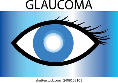 Diversos tipos de enfermedades oculares. glaucoma, calcinación, conjuntivitis, alergia ocular