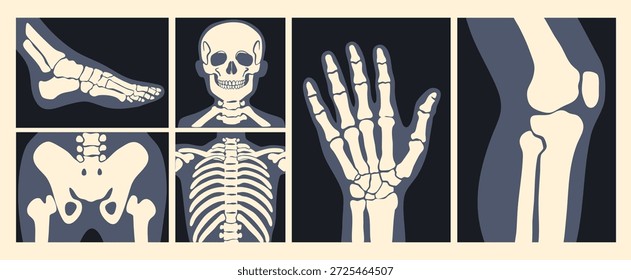 Várias imagens de raios X. Esqueleto humano, pé, pelve, braço, crânio, peito, joelho, costelas. Diferentes partes do corpo. Lesão óssea, exame médico, checkup, conceito de hospital. Ilustração de vetor desenhada à mão 