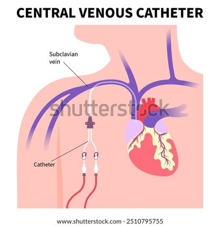 Vascular access surgery for kidney disease with intravenous injection tube on arm blood vessel in medical care