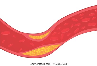 Vascular Blood Artery Vector Illustration Stock Vector (Royalty Free ...