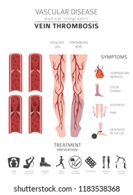Vascular diseases. Vein thrombosis symptoms, treatment icon set. Medical infographic design. Vector illustration