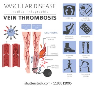 Vascular diseases. Vein thrombosis symptoms, treatment icon set. Medical infographic design. Vector illustration