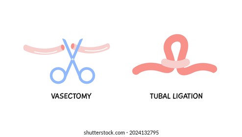 Vasectomy. Male Or Female Sterilization Concept. Tubal Ligation Colored Flat Style Icon. Women Or Man Surgical Permanent Birth Control Methods. Surgery Procedure. Vector Element Isolated On White.