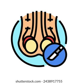 vasectomy surgery color icon vector. vasectomy surgery sign. isolated symbol illustration