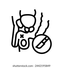 vasectomía urología línea icono vector. vasectomía urología signo. aislado contorno símbolo negro ilustración