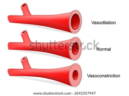 Vasoconstriction, Vasodilation, and normal artery. Comparison of normal, constricted, and dilated blood vessels. Vector illustration
