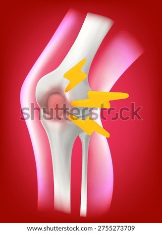 vector 3D of human knee joint in a lateral profile view realistic white bones distinct contours significant area acute pain and inflammation indicated prominent