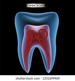 Vector 3D illustration of clipart tooth under x-ray with sid on the pulp and nerve translucent contour of the tooth three-dimensional image for the dentist's office, doctor.