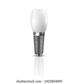 Vector 3d Realistic Render White Tooth Implant Denture Icon Set Closeup Isolated on White Background. Dental, Medicine and Health Concept. Design Template of Prosthesis Structure. Front View