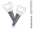 dental implant isolated