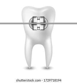 Vector 3d Realistic Tooth with Braces Icon Closeup Isolated on White Background. Medical Dentist Design Template, Clipart. Dental Health Concept