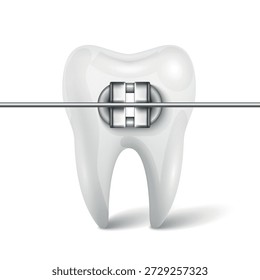 Vector 3d Tooth Braces Orthodontic Bracket. Dental Tooth with Metal Bracket and Archwire, Isolated. Orthodontics Treatment Concept. Dentistry Icon. Dental Care Clipart